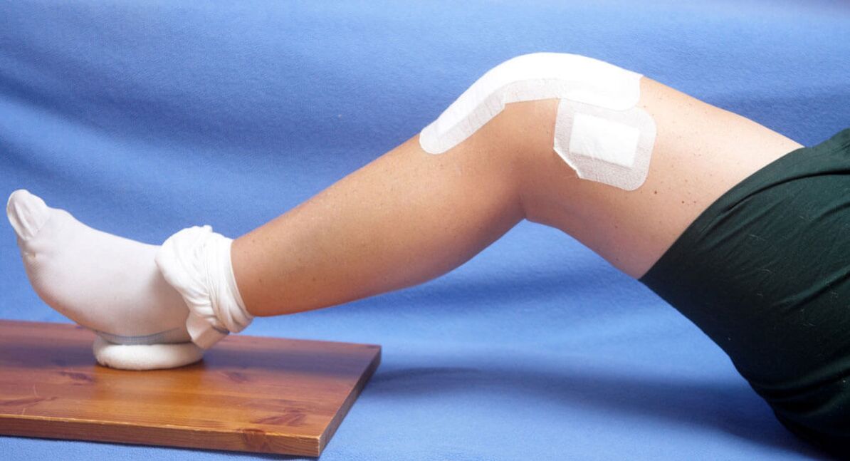 ozljeda koljena kao uzrok artroze