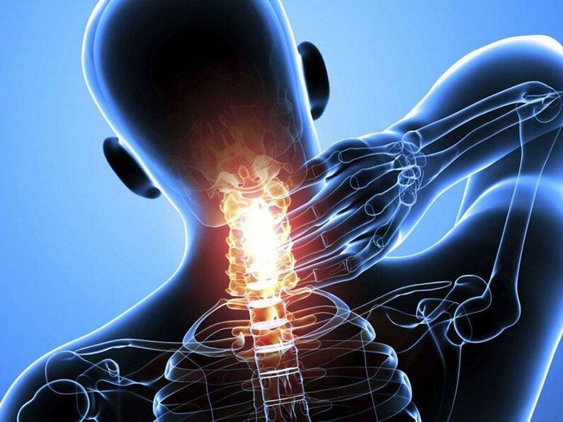 Osteohondroza vratne kičme je praćena bolom u vratu