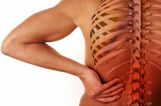 Lumbar osteohondrosis
