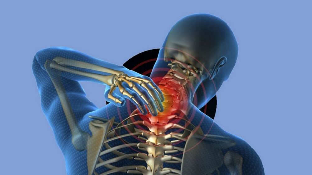 Osteohondroza regija grlića materice