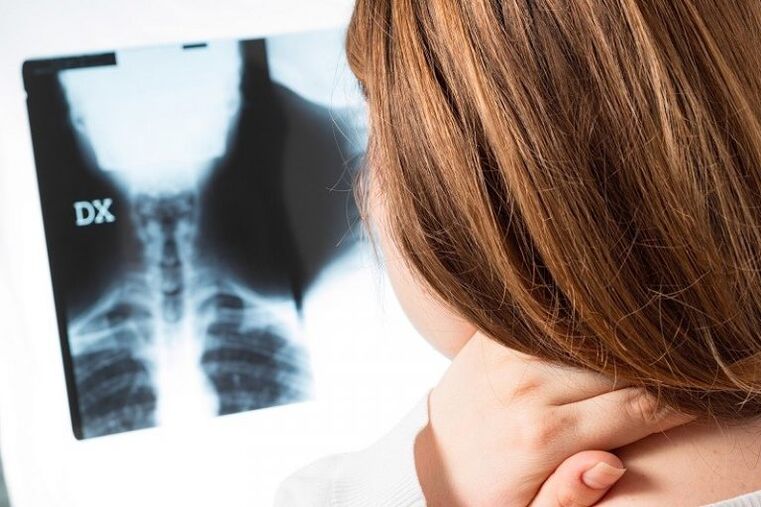 X -Ray cervikalne regije