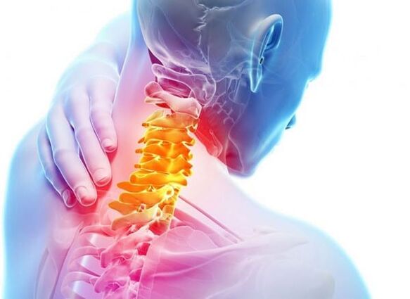 Osteohondroza grlićnje kralježnice