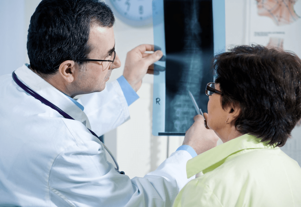 Neurolog dijagnosticira osteohondrozo pomoću radiografije kralježnice