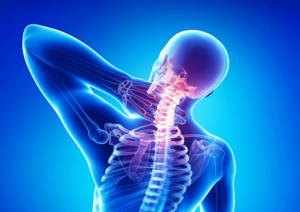 Osteohondroza kičmenog stuba